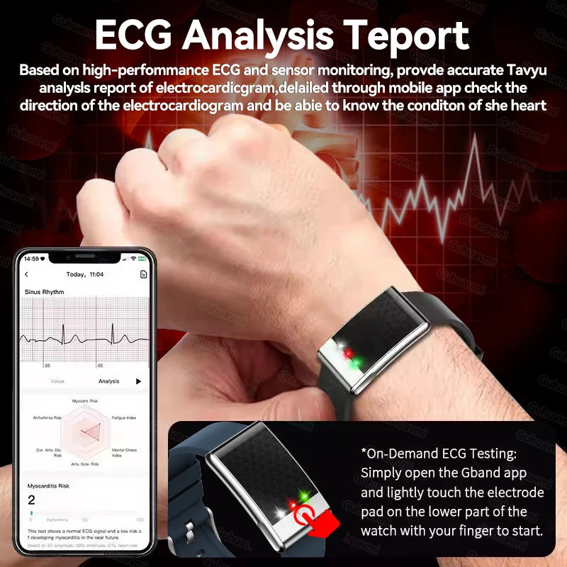 2026 No Screen Health Smart Bracelet ECG Detection Blood Lipids Uric Acid  Heart Rate IP68 Sports Smart Bracelet For Andrio IOS