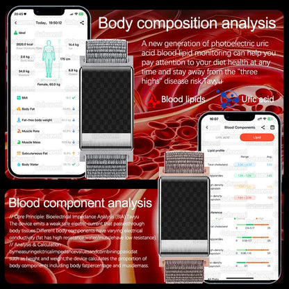 New Uric Acid Blood lipids Smart Bracelet Men ECG Blood Pressure Heart Rate Call Reminder Health Smart Bracelet No Screen Design